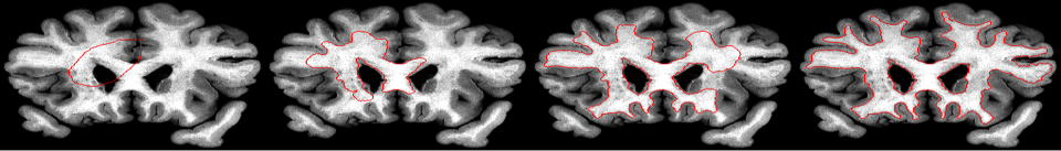 2D shape identification via Geometric Active Contours.