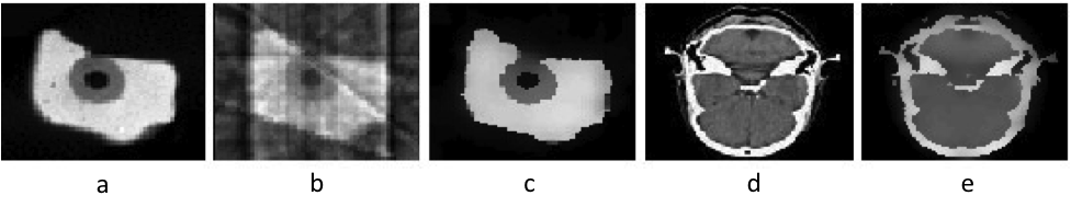 Shown left to right: (a) original bone image; (b) traditional tomographic reconstruction from partial measurements (only 9 projection images out of 256); (c) reconstruction from same partial measurements using geometric layer modeling via active surfaces; (d) original brain image (e) reconstruction from partial measurements using geometric layer modeling via active surfaces.